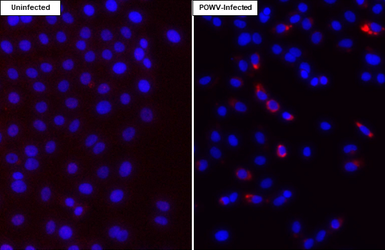Anti-Powassan virus prM protein antibody [HL4163] used in Immunocytochemistry/ Immunofluorescence (ICC/IF). GTX642968